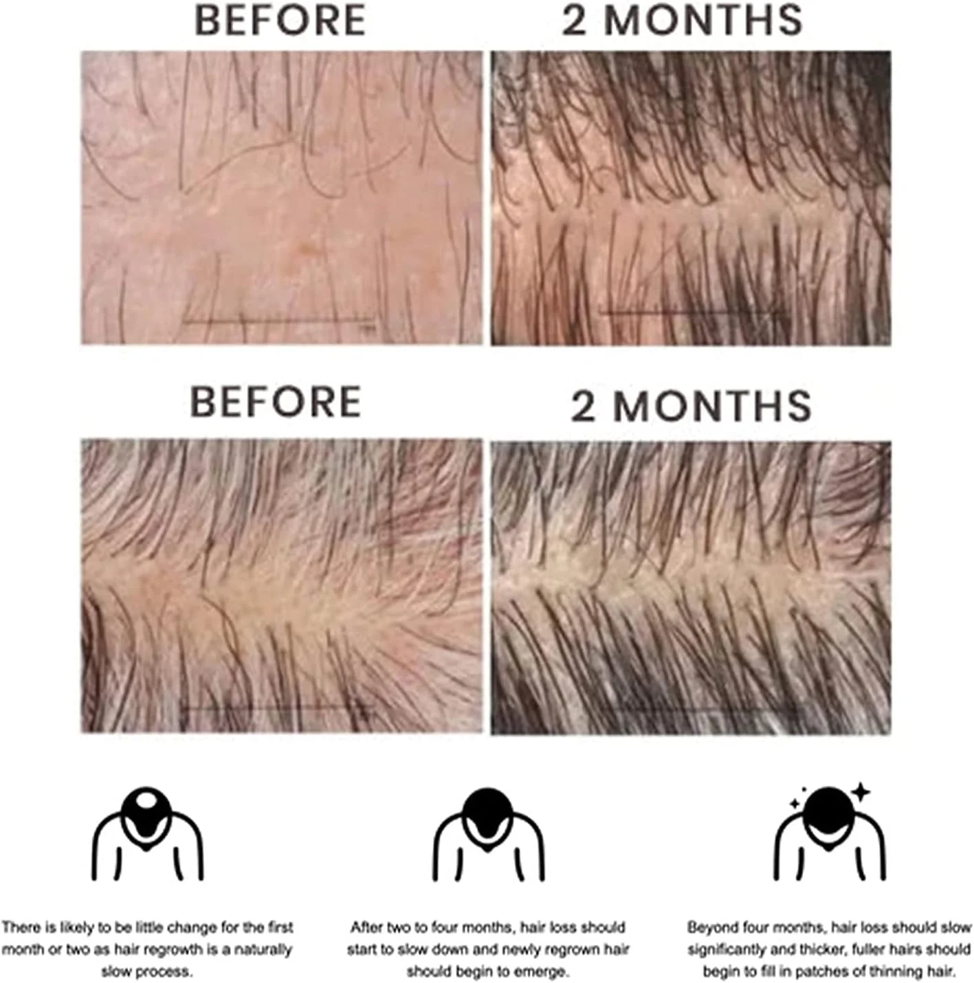 اسپری سرم فرمول رشد مو بلوسومز، اسپری رشد مو آشواگاندا 4500، سرم مو برای موهای خشک و آسیب دیده (1 عدد) اسپری سرم فرمول رشد مو بلوسومز، اسپری رشد مو آشواگاندا 4500، سرم مو برای موهای خشک و آسیب دیده (1 عدد)