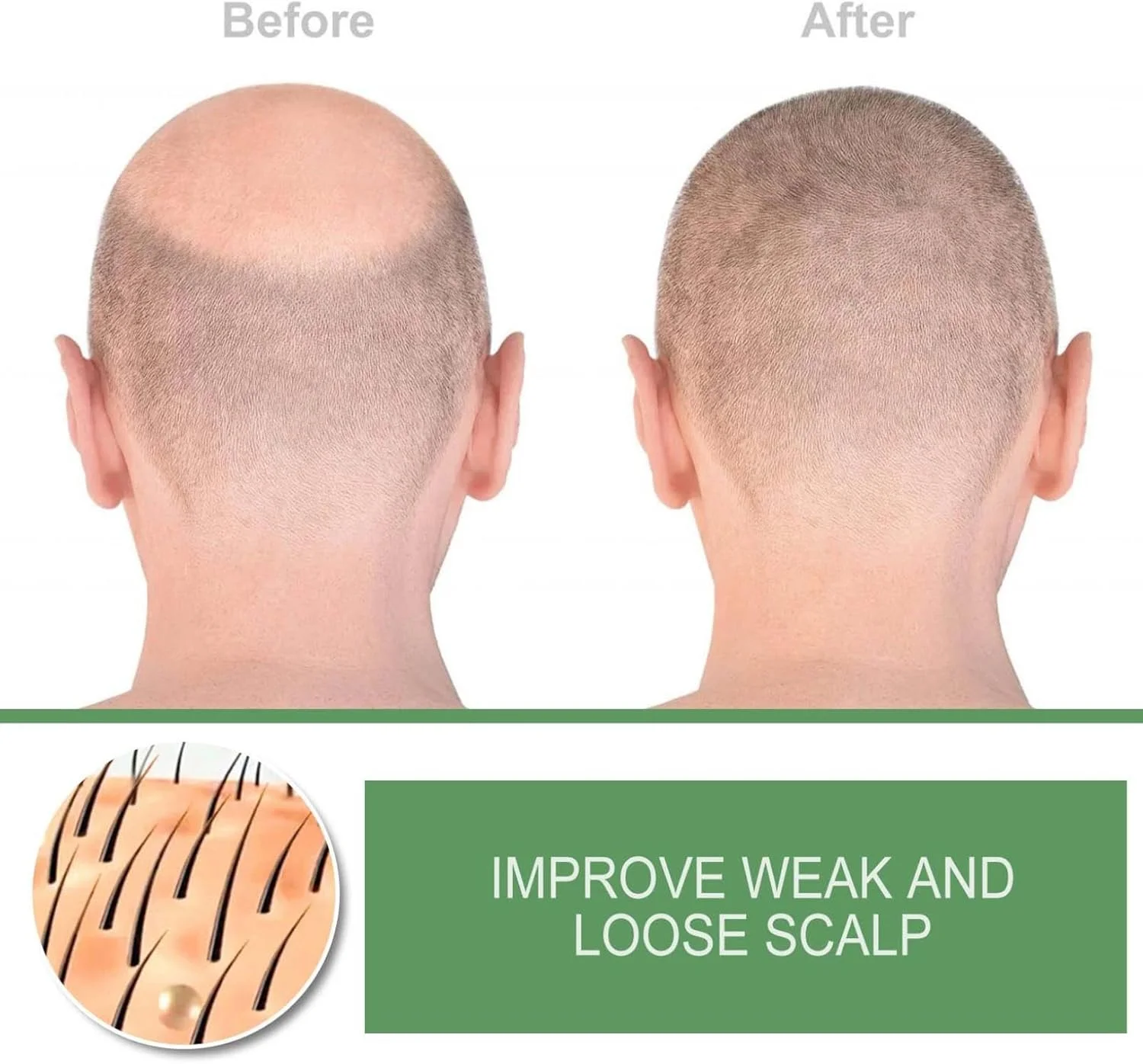 اسپری ترمیم کننده پوست سر موی زیتون بلوسومز، اسپری سرم فرمول رشد مو بلوسومز، اسپری مو روغن زیتون، اسپری زنجبیل مغذی رشد مجدد، روغن سرم رشد مو برای رشد موهای خشک و آسیب دیده (3 عدد) اسپری ترمیم کننده پوست سر موی زیتون بلوسومز، اسپری سرم فرمول رشد مو بلوسومز، اسپری مو روغن زیتون، اسپری زنجبیل مغذی رشد مجدد، روغن سرم رشد مو برای رشد موهای خشک و آسیب دیده (3 عدد)