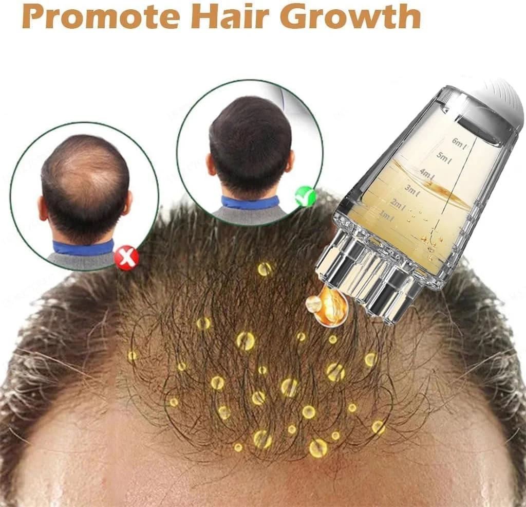 شانه اپلیکاتور روغن مو ZONVER، بطری اپلیکاتور شانه ریشه صاف برای روغن پوست سر، پخش کننده لوسیون ضد ریزش مو، ضد نشت، کنترل مقیاس 6 میلی لیتری، مراقبت از سالن، موهای چرب (6 میلی لیتر)