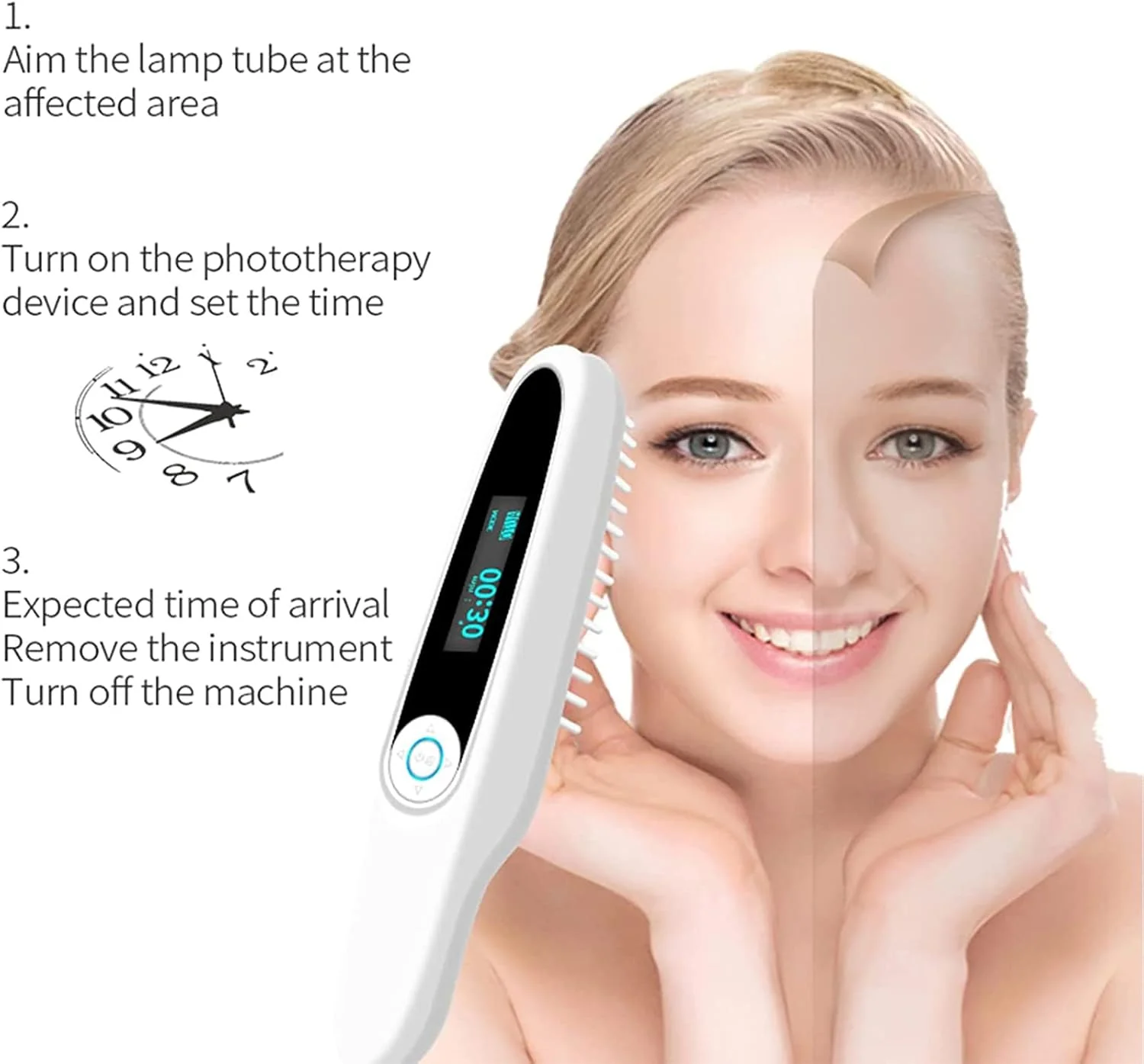 چراغ فتوتراپی باند باریک SOSSEG 311nm، دستگاه چراغ درمانی LED UVB، چراغ های مراقبت از پوست UVB با کنترل تایمر دیجیتال و عینک برای استفاده خانگی قابل حمل (اندازه: 1) چراغ فتوتراپی باند باریک SOSSEG 311nm، دستگاه چراغ درمانی LED UVB، چراغ های مراقبت از پوست UVB با کنترل تایمر دیجیتال و عینک برای استفاده خانگی قابل حمل (اندازه: 1)