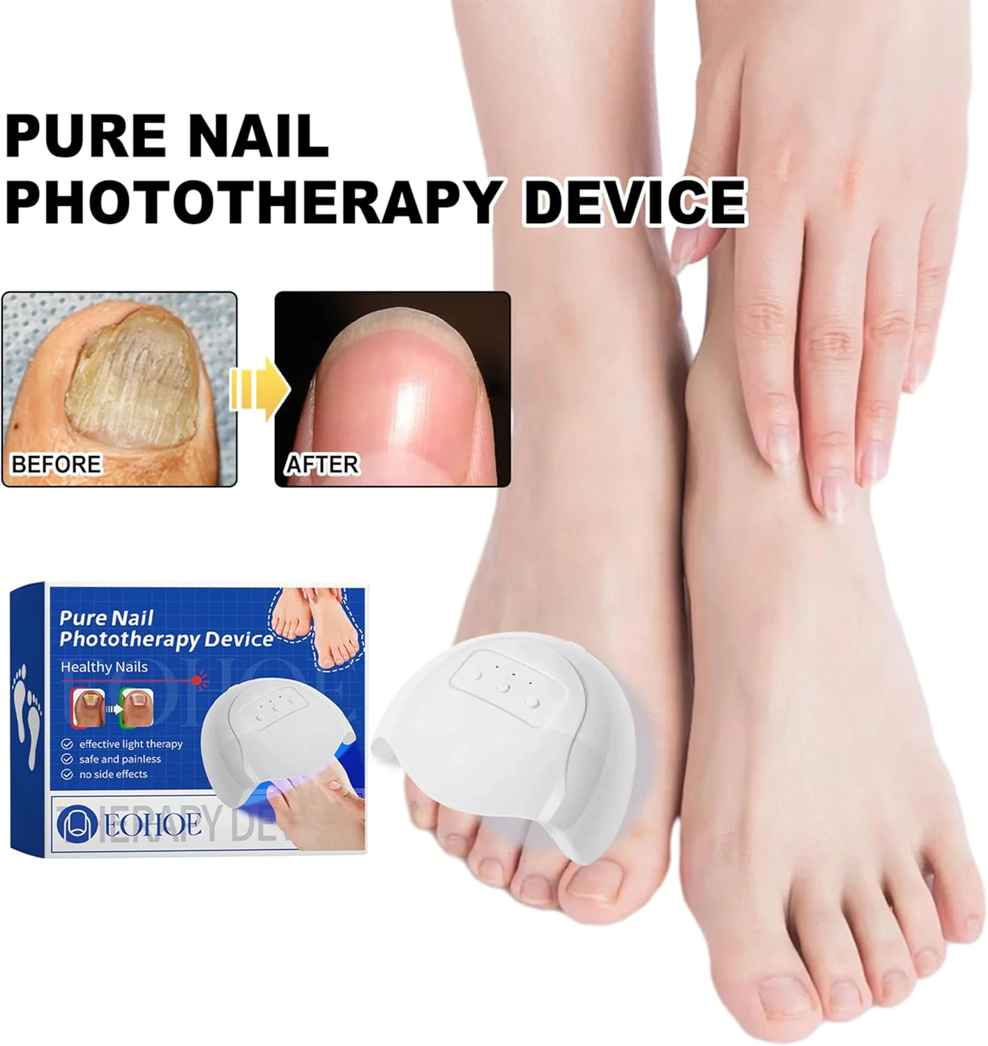 دستگاه درمان قارچ ناخن Elitzia با نور UV و 12 چراغ LED، دارای 3 گزینه زمانی، مناسب برای درمان ناخن های پا و دست، مدل ETNL02