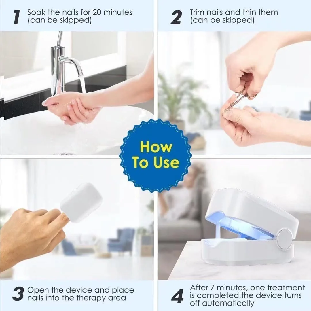 دستگاه درمان قارچ ناخن Metoo، واجد شرایط FSA/HSA، سفید، ضد قارچ، لیزر مراقبت از ناخن برای استفاده خانگی، 1 عدد