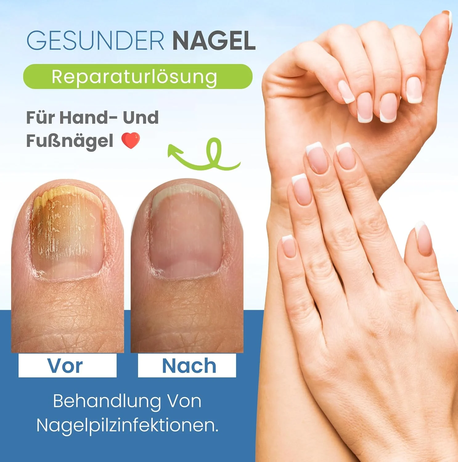 دستگاه لیزر قارچ ناخن قابل شارژ Med-Fit (با استفاده از دیودهای لیزری ساخت آلمان) - درمان بسیار موثر قارچ ناخن دستگاه لیزر قارچ ناخن قابل شارژ Med-Fit (با استفاده از دیودهای لیزری ساخت آلمان) - درمان بسیار موثر قارچ ناخن