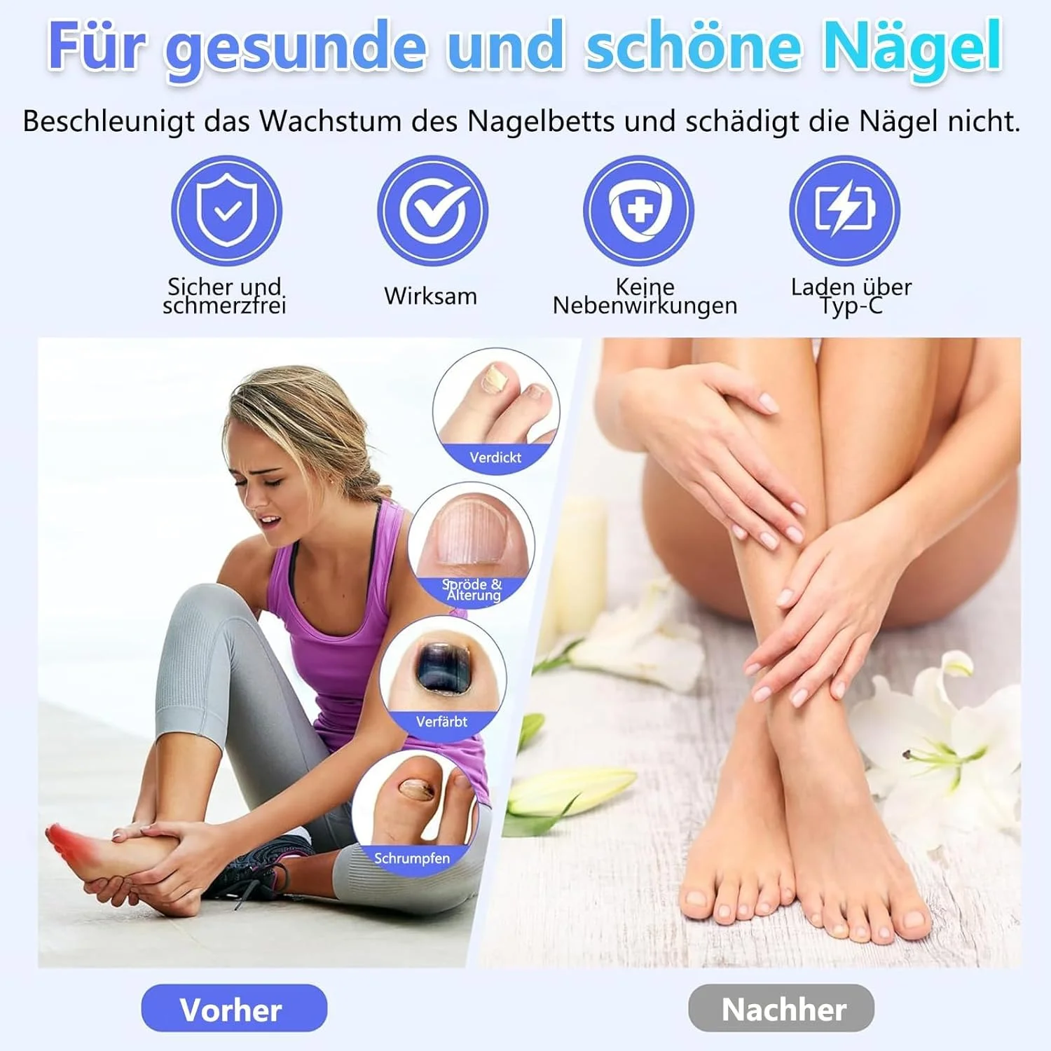 دستگاه لیزر قارچ ناخن Podoclear برای چندین ناخن دست و پا، ناخن های آسیب دیده و تغییر رنگ داده، با عملکرد زمان بندی نمایشگر دیجیتال