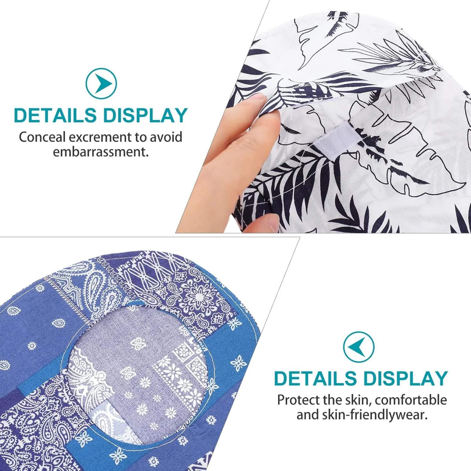 MNDEAN 3 عدد روکش کیسه استومی کشسان، روکش جهانی کیسه کولوستومی، لوازم پزشکی استومی