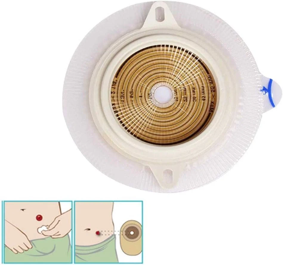 کمربند استومی تابستانی، بند استومی با مهر و موم ساده، 10 عدد کمربند استومی تابستانی، بند استومی با مهر و موم ساده، 10 عدد