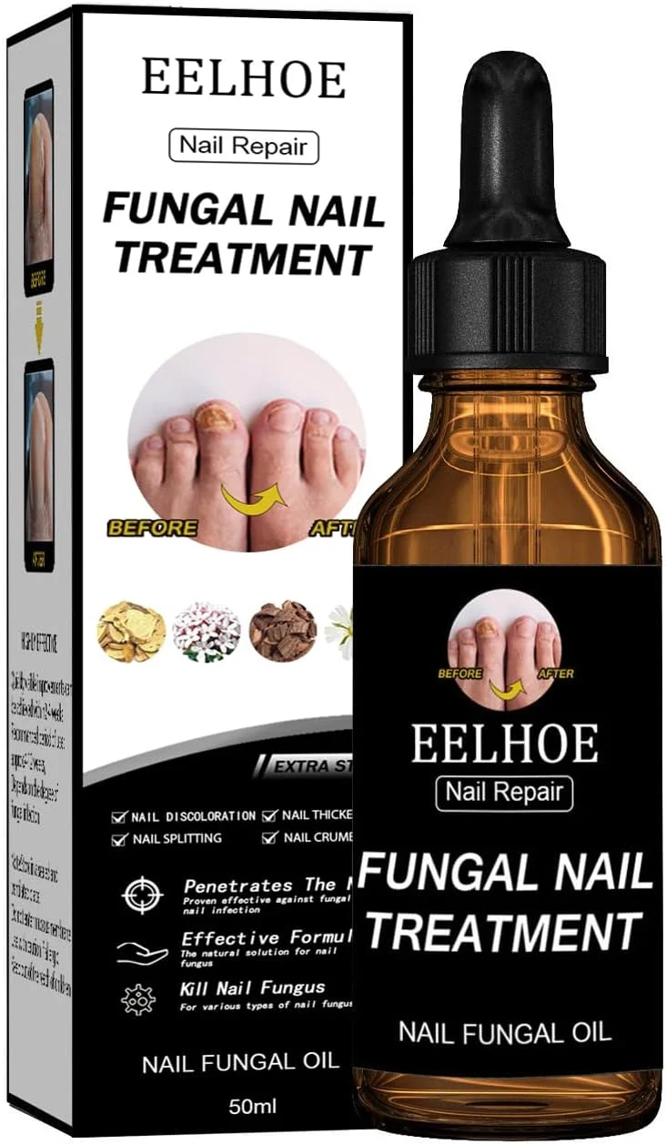 روغن درمان قارچ ناخن با قدرت فوق العاده - روغن ضد قارچ ناخن حاوی گلیسیرین و پانتنول، 4 عصاره گیاهی خالص طبیعی، مناسب برای ناخن های آسیب دیده قارچی، تغییر رنگ ناخن ها، پسوریازیس ناخن، پیری ناخن، 50 میلی لیتر