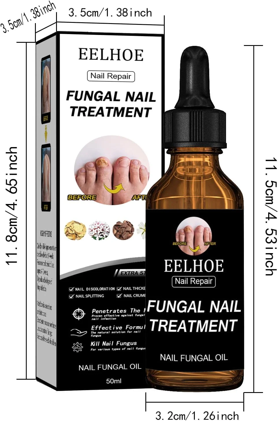 روغن درمان قارچ ناخن با قدرت فوق العاده - روغن ضد قارچ ناخن حاوی گلیسیرین و پانتنول، 4 عصاره گیاهی خالص طبیعی، مناسب برای ناخن های آسیب دیده قارچی، تغییر رنگ ناخن ها، پسوریازیس ناخن، پیری ناخن، 50 میلی لیتر