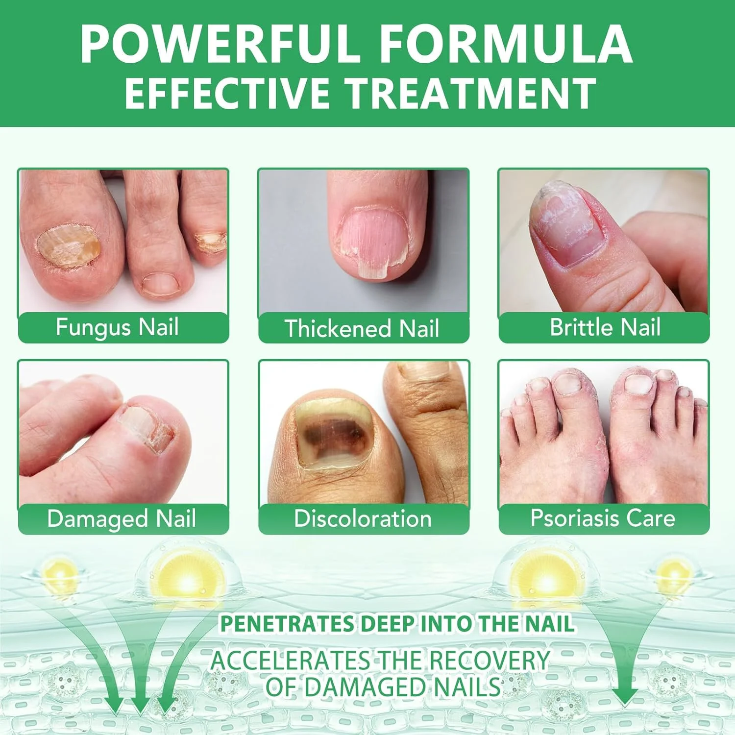 سرم درمان ناخن زنجبیلی 7 روزه، روغن گیاهی طبیعی برای رشد ناخن، ترمیم فشرده ناخن های آسیب دیده و لبه های ناخن، دست و پا، 60 میلی لیتر