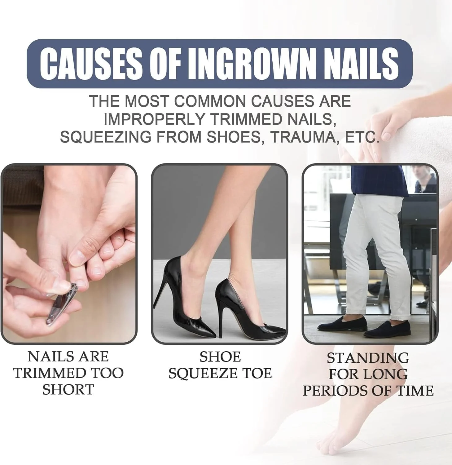 روغن مراقبت از ناخن پا، محلول تسکین دهنده و ترمیم کننده ناخن، نرم کننده ناخن های فرورفته، درمان ناخن پا و قارچ پا، درمان ضد عفونت ناخن، 2 عدد برای ناخن های سالم تر