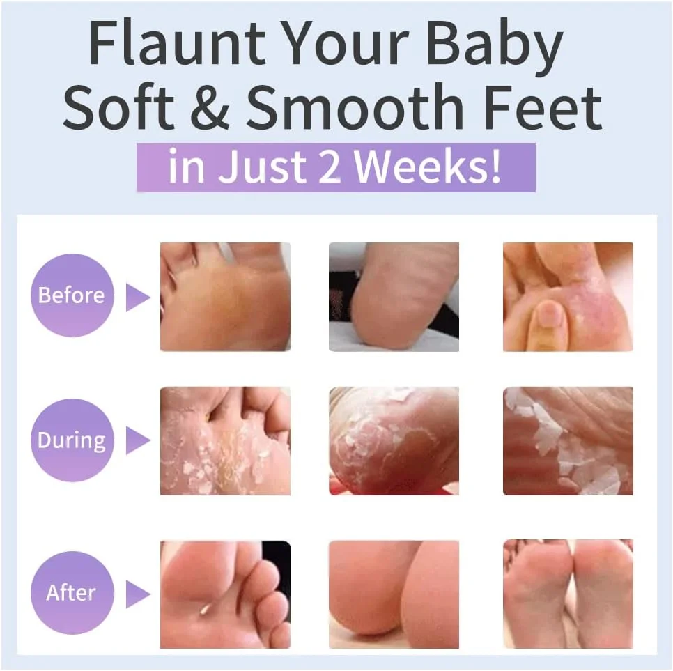 مجموعه ماسک لایه بردار دست و پا 6 جفتی، ماسک لایه بردار پا برای مراقبت از پاهای خشک و ترک خورده و آبرسانی، ماسک های لایه بردار پا 4 عددی + ماسک لایه بردار دست، برای خانم ها برای از بین بردن پوست مرده ماسک های دست و پا مجموعه ماسک لایه بردار دست و پا 6 جفتی، ماسک لایه بردار پا برای مراقبت از پاهای خشک و ترک خورده و آبرسانی، ماسک های لایه بردار پا 4 عددی + ماسک لایه بردار دست، برای خانم ها برای از بین بردن پوست مرده ماسک های دست و پا