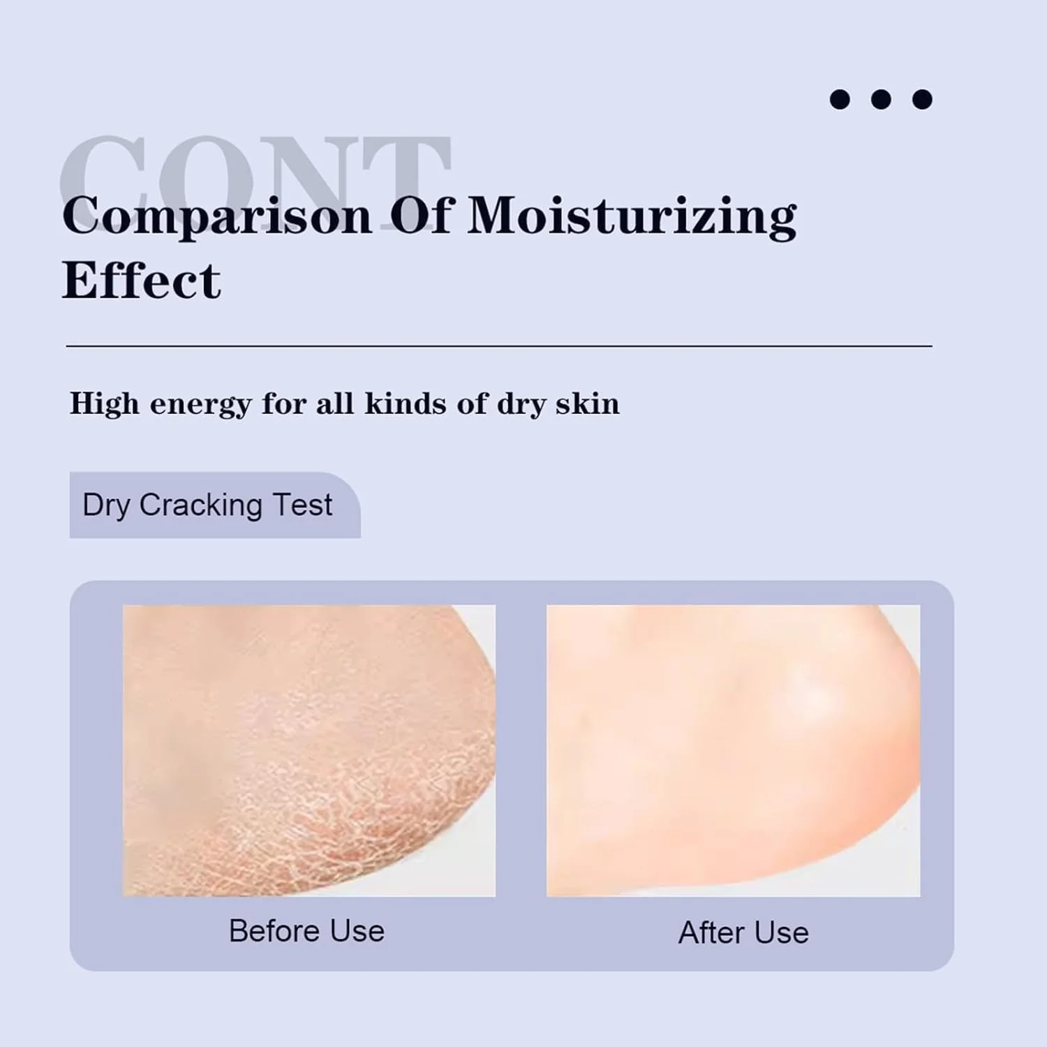 کرم پای اوره TERRIFI - ترمیم ترک پاشنه پا و مرطوب کننده قوی برای پوست خشک، مراقبت از پا برای پاهای بسیار خشک، دست ها و بدن کرم پای اوره TERRIFI - ترمیم ترک پاشنه پا و مرطوب کننده قوی برای پوست خشک، مراقبت از پا برای پاهای بسیار خشک، دست ها و بدن