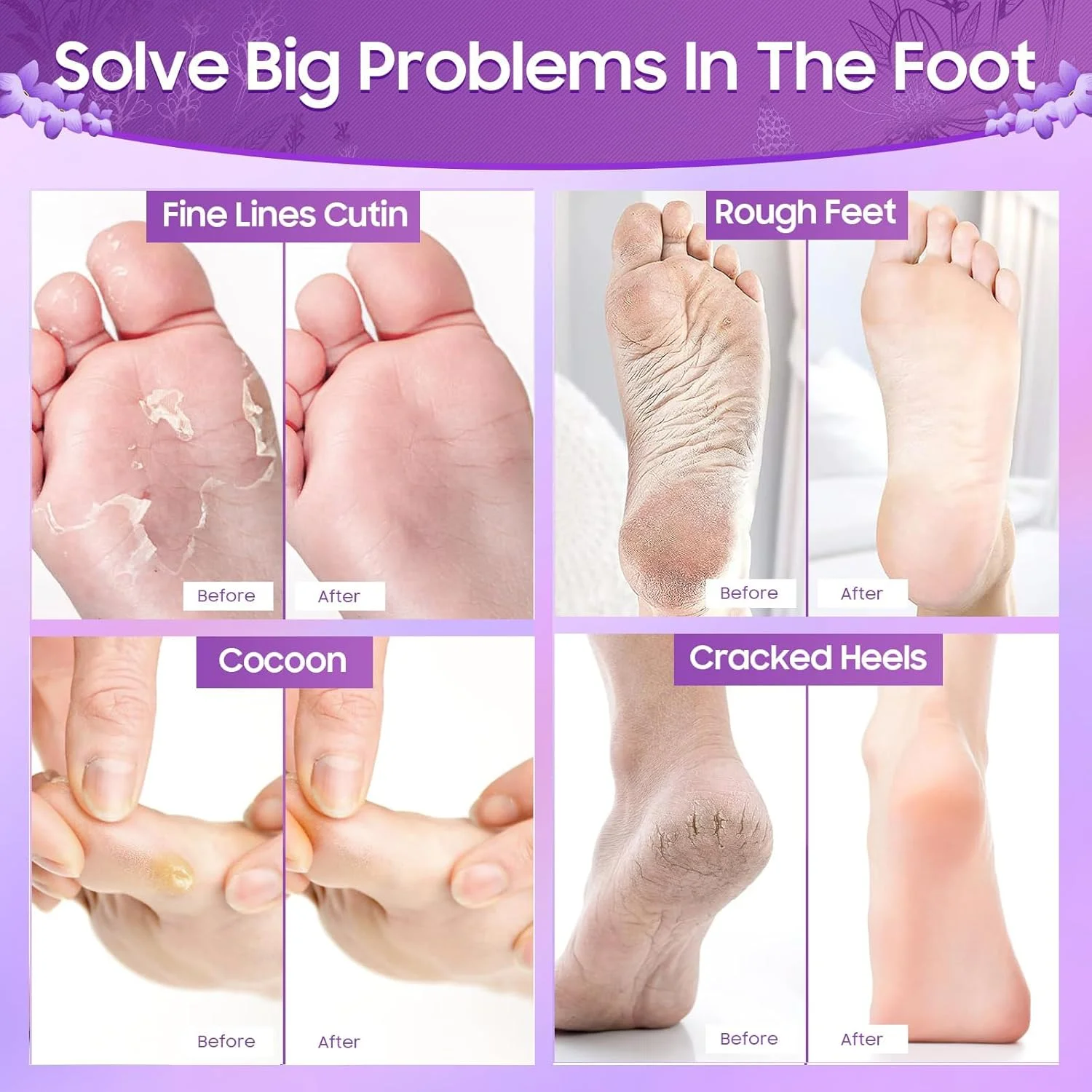 ماسک لایه بردار پا TERRIFI، 4 جفت ماسک پا لایه بردار، لایه بردار طبیعی برای پوست خشک و مرده، پینه، ترمیم پاشنه های زبر، مراقبت بیشتر از پا برای آقایان و خانم ها