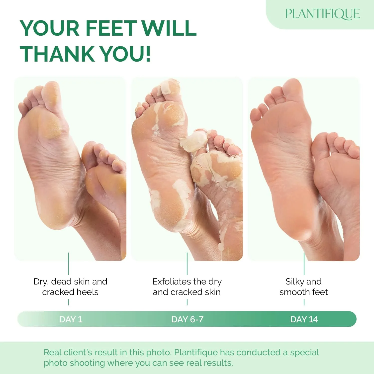 ماسک لایه بردار پا پلنتیفیک، تست شده توسط متخصصین پوست، ترمیم کننده پاشنه پا و از بین برنده پوست های خشک و مرده برای داشتن پاهایی نرم و لطیف - ماسک لایه بردار پا برای پاهای خشک و ترک خورده (اسطوخودوس 2 عددی)