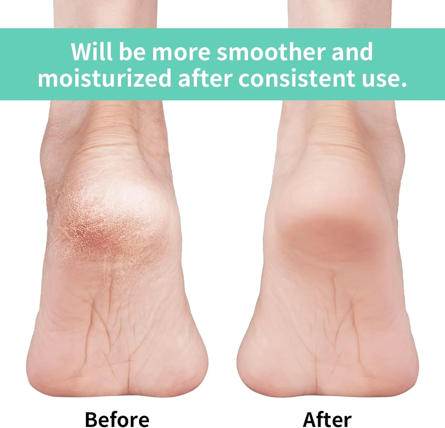۴ جفت جوراب پاشنه ژله ای مرطوب کننده - مراقبت از پا بدون انگشت برای پاهای ترک خورده، ژل سیلیکونی برای ترمیم پاشنه و پوست خشک، درمان شبانه