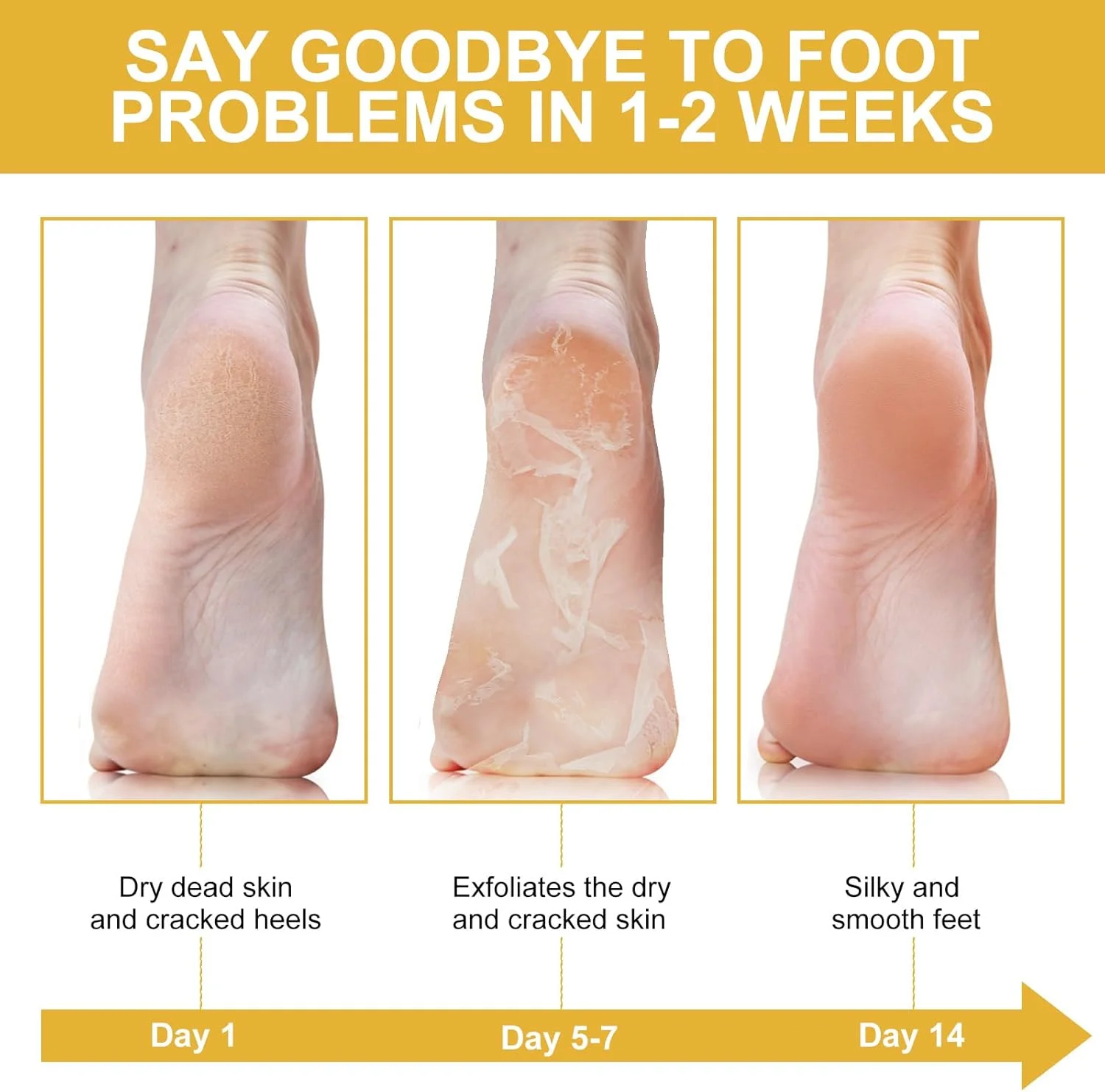 ماسک لایه بردار پا ALIVER، بسته 3 عددی، لایه برداری طبیعی برای از بین بردن پینه و سلول های مرده پوست، نرم کننده پوست پا، ترمیم پاشنه های زبر برای آقایان و بانوان - بابونه ماسک لایه بردار پا ALIVER، بسته 3 عددی، لایه برداری طبیعی برای از بین بردن پینه و سلول های مرده پوست، نرم کننده پوست پا، ترمیم پاشنه های زبر برای آقایان و بانوان - بابونه