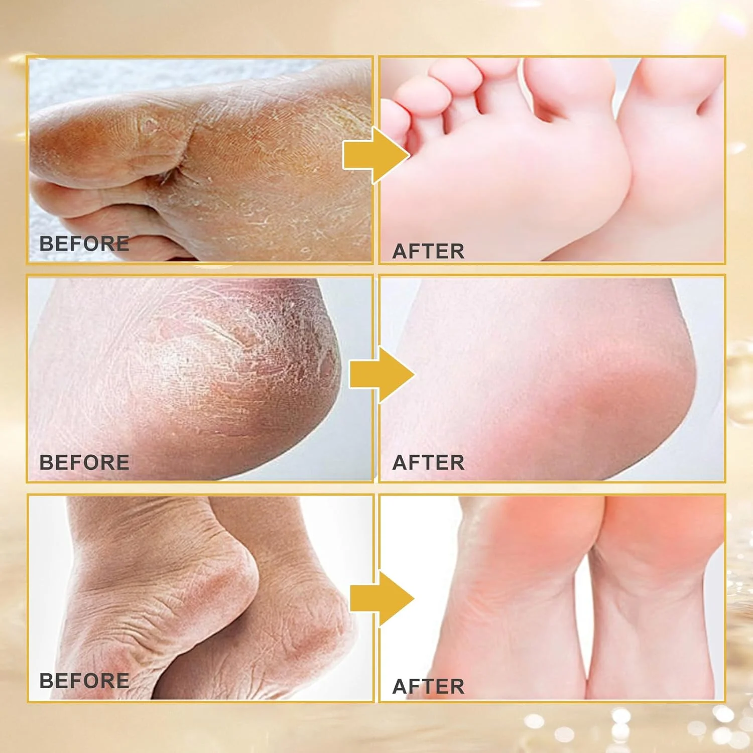 ماسک لایه بردار پا ALIVER، بسته 3 عددی، لایه برداری طبیعی برای از بین بردن پینه و سلول های مرده پوست، نرم کننده پوست پا، ترمیم پاشنه های زبر برای آقایان و بانوان - بابونه ماسک لایه بردار پا ALIVER، بسته 3 عددی، لایه برداری طبیعی برای از بین بردن پینه و سلول های مرده پوست، نرم کننده پوست پا، ترمیم پاشنه های زبر برای آقایان و بانوان - بابونه