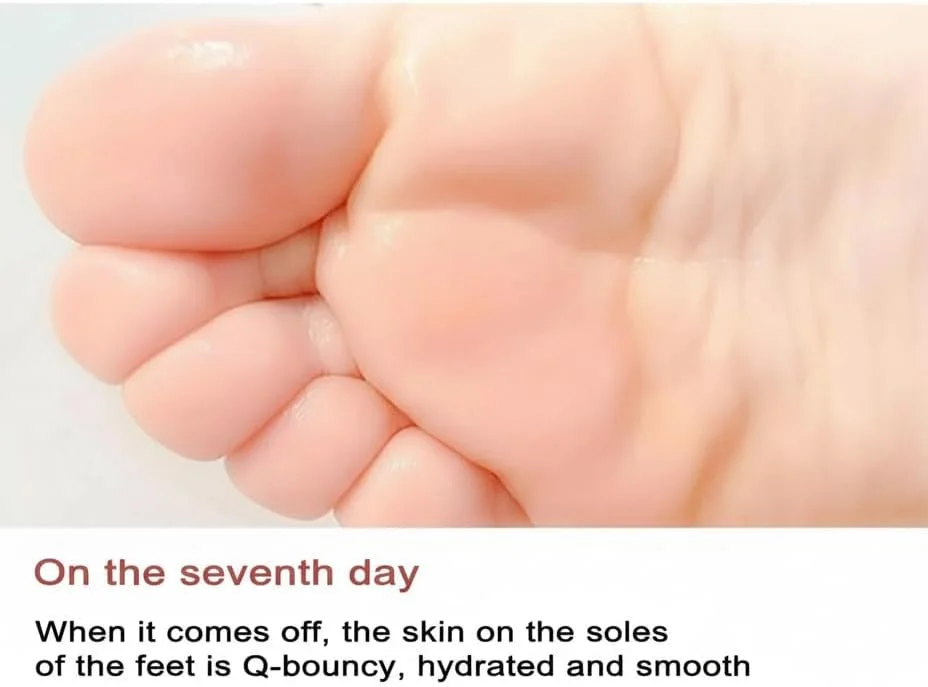 ماسک لایه بردار پا NALACAL، جوراب مرطوب کننده ماسک پا، ماسک ورقه ای مراقبت از پا 4 عددی، از بین برنده پینه پا، ایده آل برای لایه برداری، ترک پاشنه پا و پوست سفت، درمان مرطوب کننده و از بین برنده پوست مرده