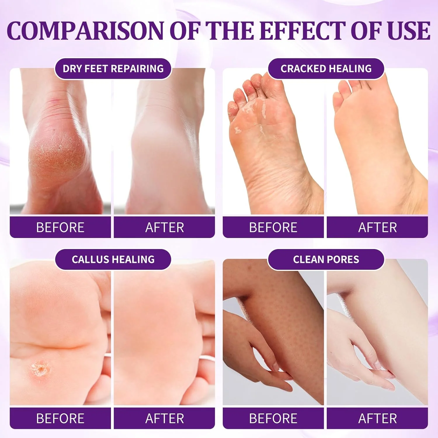 مجموعه پدیکور و مراقبت از پا: نمک حباب دار، اسکراب شکر، ماسک ماساژ، لوسیون ماساژ در یک جعبه، مجموعه 4 مرحله ای اسپا پا برای پاهای خشک و خسته (1 ست اسطوخودوس) مجموعه پدیکور و مراقبت از پا: نمک حباب دار، اسکراب شکر، ماسک ماساژ، لوسیون ماساژ در یک جعبه، مجموعه 4 مرحله ای اسپا پا برای پاهای خشک و خسته (1 ست اسطوخودوس)