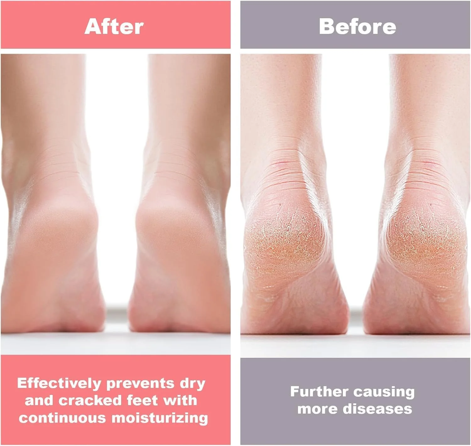 جوراب سیلیکونی مرطوب کننده، 2 جفت ماسک پا برای پاهای خشک و ترک خورده، درمان مراقبت از پا با ژل ضخیم، لایه برداری و آبرسانی اسپا پا، طراحی ضد لغزش برای زنان، قابل استفاده مجدد و تمیز کردن آسان