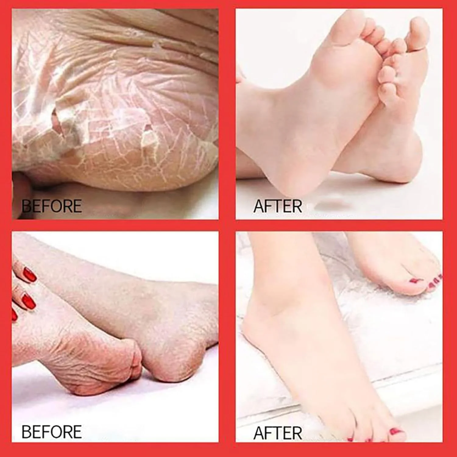 ماسک لایه بردار پا، بسته 4 عددی جوراب ماسک مرطوب کننده پا، از بین برنده پینه برای پاشنه های ترک خورده و پوست سفت، درمان لایه برداری عمیق پا، آبرسانی و نرم کننده پاهای خشک، بازگرداندن پوست صاف و سالم ماسک لایه بردار پا، بسته 4 عددی جوراب ماسک مرطوب کننده پا، از بین برنده پینه برای پاشنه های ترک خورده و پوست سفت، درمان لایه برداری عمیق پا، آبرسانی و نرم کننده پاهای خشک، بازگرداندن پوست صاف و سالم