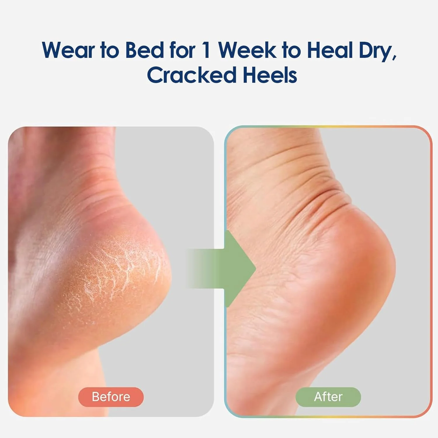 جوراب پاشنه مرطوب کننده برای ترک پا، جوراب سیلیکونی، جوراب پاشنه ژلی مرطوب کننده برای خشکی و ترک پا، قابل استفاده مجدد، مناسب استفاده در اسپا و هنگام خواب برای ترمیم رطوبت پا جوراب پاشنه مرطوب کننده برای ترک پا، جوراب سیلیکونی، جوراب پاشنه ژلی مرطوب کننده برای خشکی و ترک پا، قابل استفاده مجدد، مناسب استفاده در اسپا و هنگام خواب برای ترمیم رطوبت پا