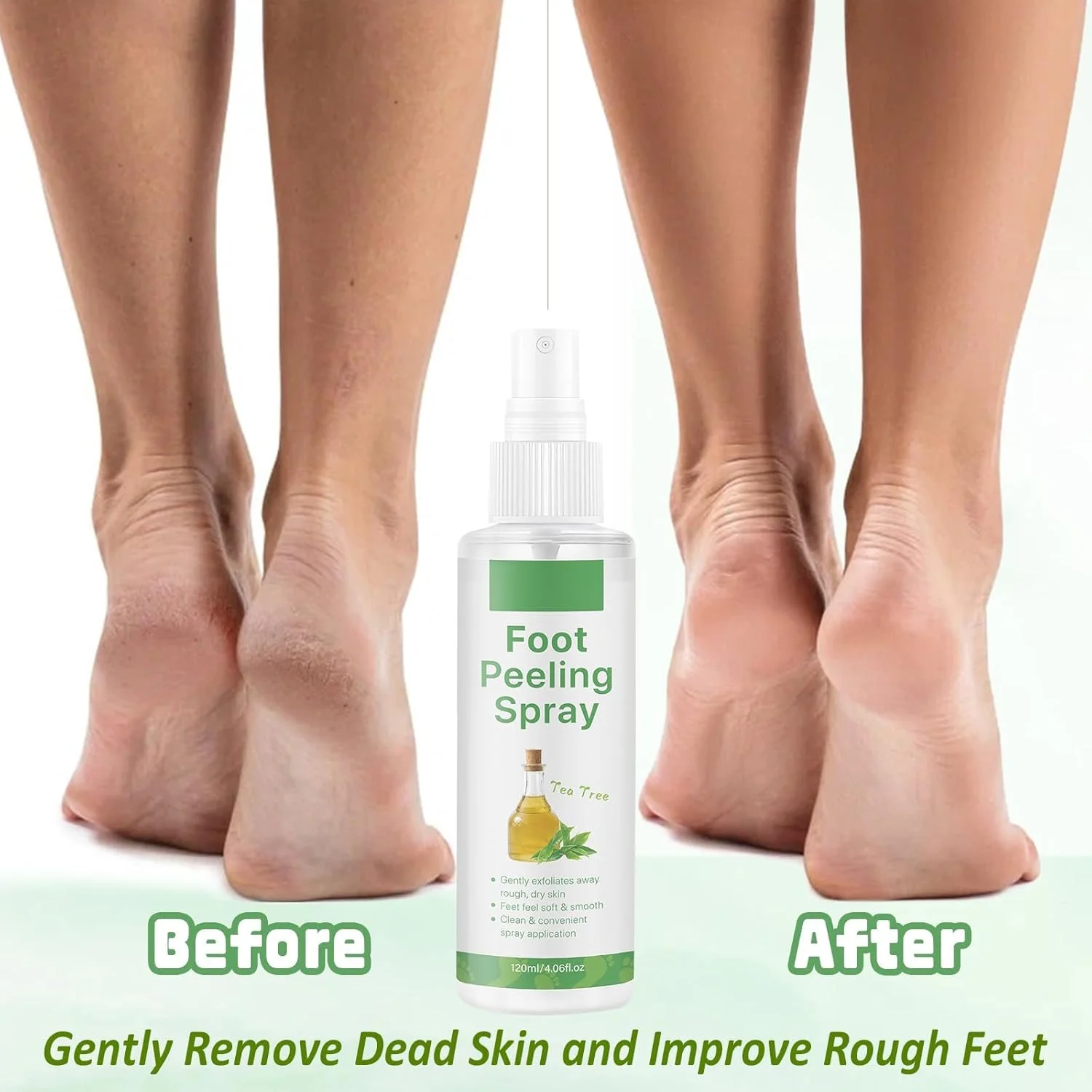 اسپری لایه بردار پا با عصاره درخت چای، 120 میلی لیتر، اسپری لایه بردار گیاهی و وگان پا، مرطوب کننده و نرم کننده پوست پا، لایه برداری ملایم پوست های زبر، از بین بردن پوست های مرده پا در چند ثانیه