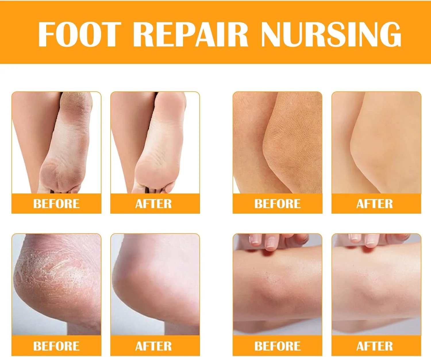 اسپری روغن لایه بردار پا، اسپری لایه بردار پا، لایه بردار پوست مرده پدیکور برای پاشنه های ترک خورده و زبر، پوست خشک انگشتان پا و پینه ها، حذف سریع پوست مرده (100 میلی لیتر) (نارنجی) اسپری روغن لایه بردار پا، اسپری لایه بردار پا، لایه بردار پوست مرده پدیکور برای پاشنه های ترک خورده و زبر، پوست خشک انگشتان پا و پینه ها، حذف سریع پوست مرده (100 میلی لیتر) (نارنجی)