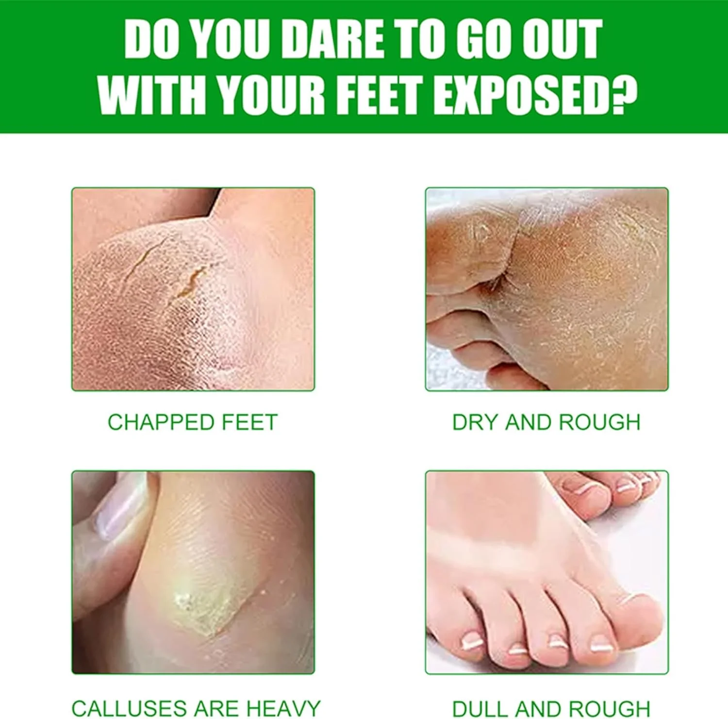 ماسک لایه بردار پا KASTWAVE، بسته 3 عددی، ماسک مرطوب کننده پا، لایه برداری پوست مرده و از بین برنده پینه، ساخته شده با عصاره آلوئه ورا، ماسک لایه بردار پا برای داشتن پاهایی نرم و لطیف مانند پای کودک، مناسب برای خانم ها و آقایان