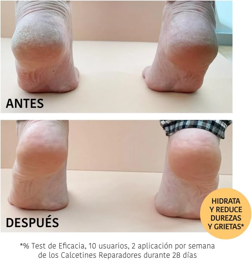 ایروها نیچر - ماسک جورابی ترمیم کننده پا - هلو ایروها نیچر - ماسک جورابی ترمیم کننده پا - هلو