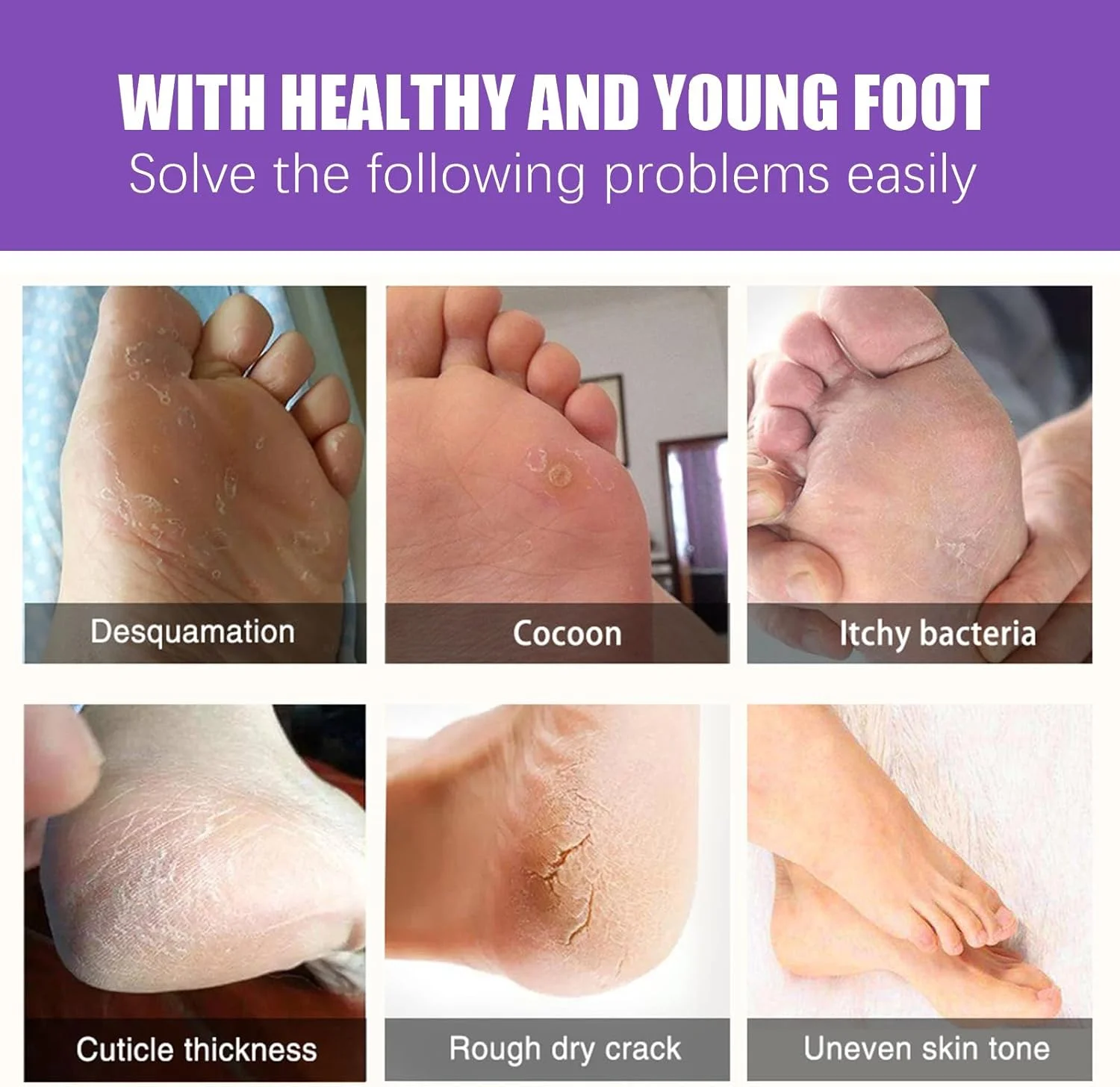 ماسک لایه بردار پا زنجبیلی 丨 ماسک پا برای خشکی، از بین بردن پینه و پوست مرده 丨 تسکین پوست، مرطوب کننده عمیق، مراقبت از پا 丨 4 جفت ماسک لایه بردار پا زنجبیلی 丨 ماسک پا برای خشکی، از بین بردن پینه و پوست مرده 丨 تسکین پوست، مرطوب کننده عمیق، مراقبت از پا 丨 4 جفت