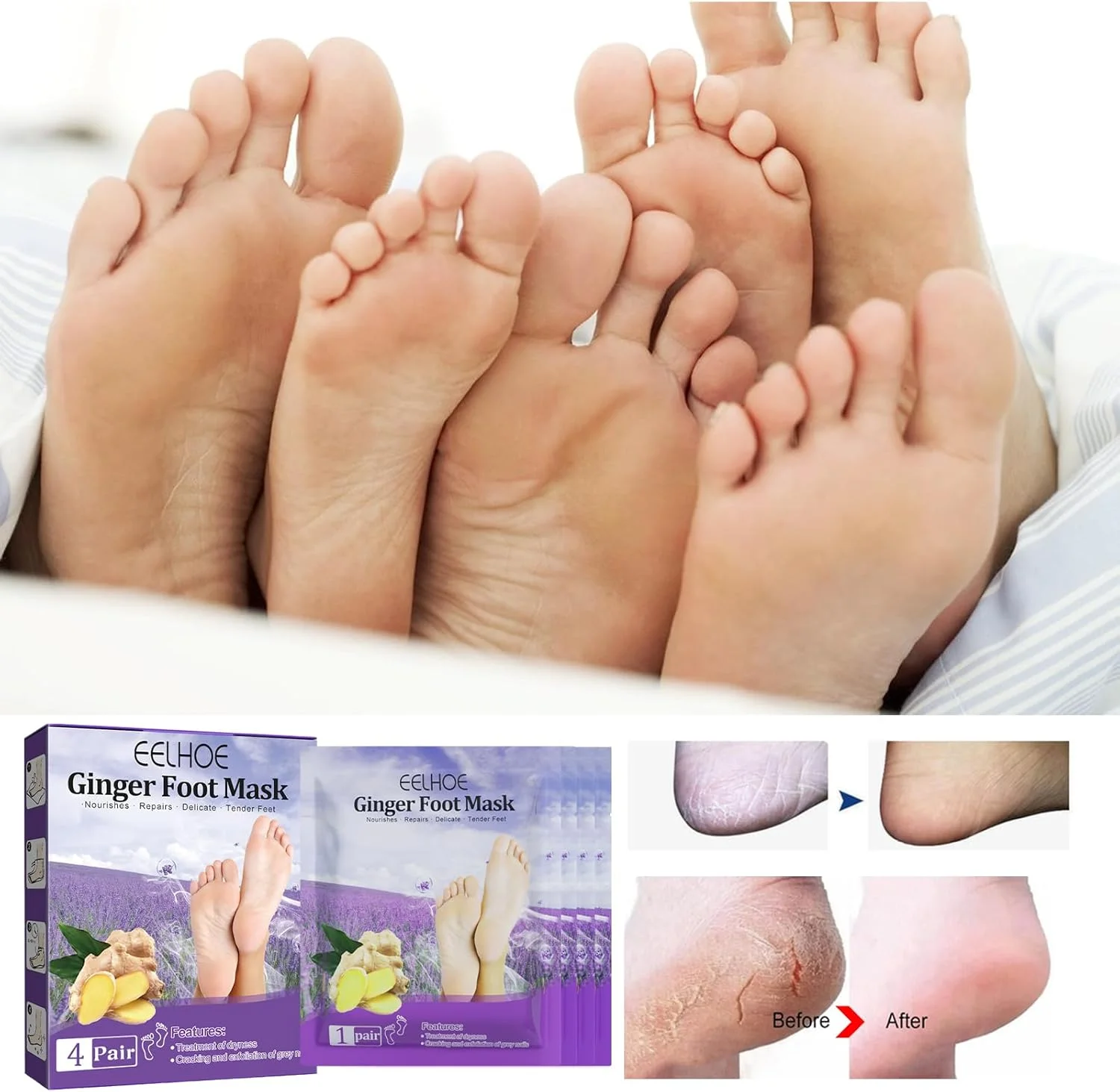 ماسک لایه بردار پا زنجبیلی 丨 ماسک پا برای خشکی، از بین بردن پینه و پوست مرده 丨 تسکین پوست، مرطوب کننده عمیق، مراقبت از پا 丨 4 جفت ماسک لایه بردار پا زنجبیلی 丨 ماسک پا برای خشکی، از بین بردن پینه و پوست مرده 丨 تسکین پوست، مرطوب کننده عمیق، مراقبت از پا 丨 4 جفت