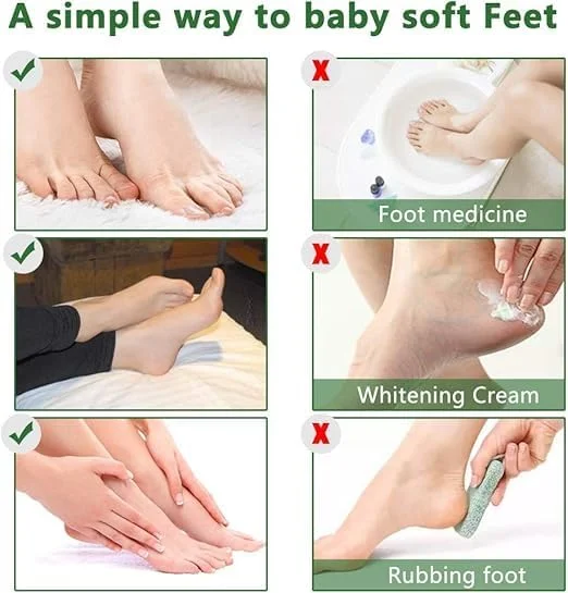 ماسک لایه بردار پا - بسته 5 عددی، ماسک مراقبت از پا برای داشتن پاهایی نرم مانند پای کودک، لایه بردار پا برای ترمیم پوست مرده، پینه، ترک خوردگی و زبری پا