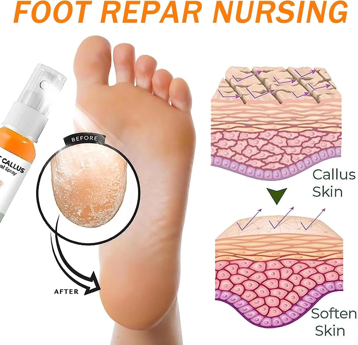 اسپری لایه بردار پا، از بین برنده پوست سخت و ماسک لایه بردار با روغن پرتقال - اسپری لایه بردار آبرسان برای از بین بردن سریع پینه و پوست مرده، ایده آل برای مراقبت از پا (سایز مسافرتی 30 میلی لیتر)