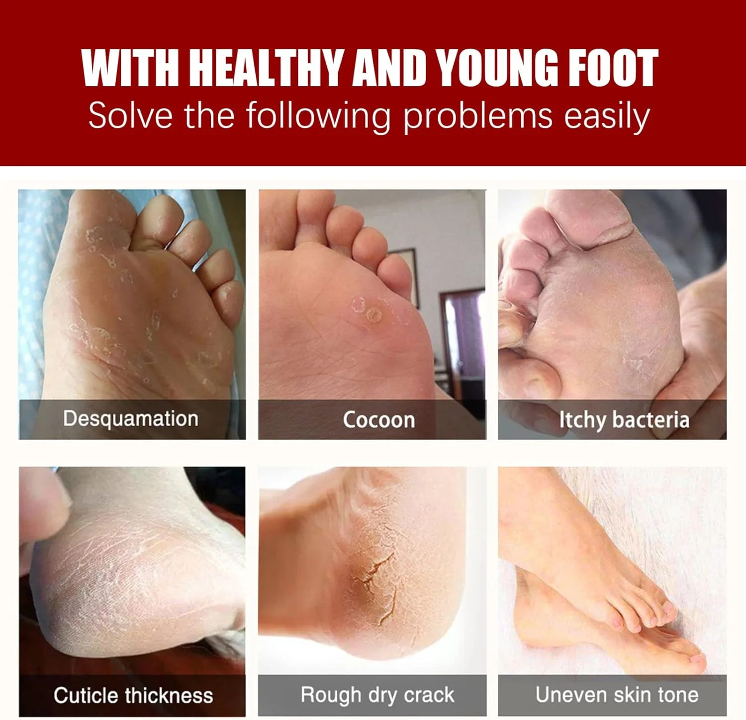 جفت ماسک پا لایه بردار، مرطوب کننده و آبرسان، از بین برنده پوست مرده، سازگار با پوست، صاف کننده پا جفت ماسک پا لایه بردار، مرطوب کننده و آبرسان، از بین برنده پوست مرده، سازگار با پوست، صاف کننده پا