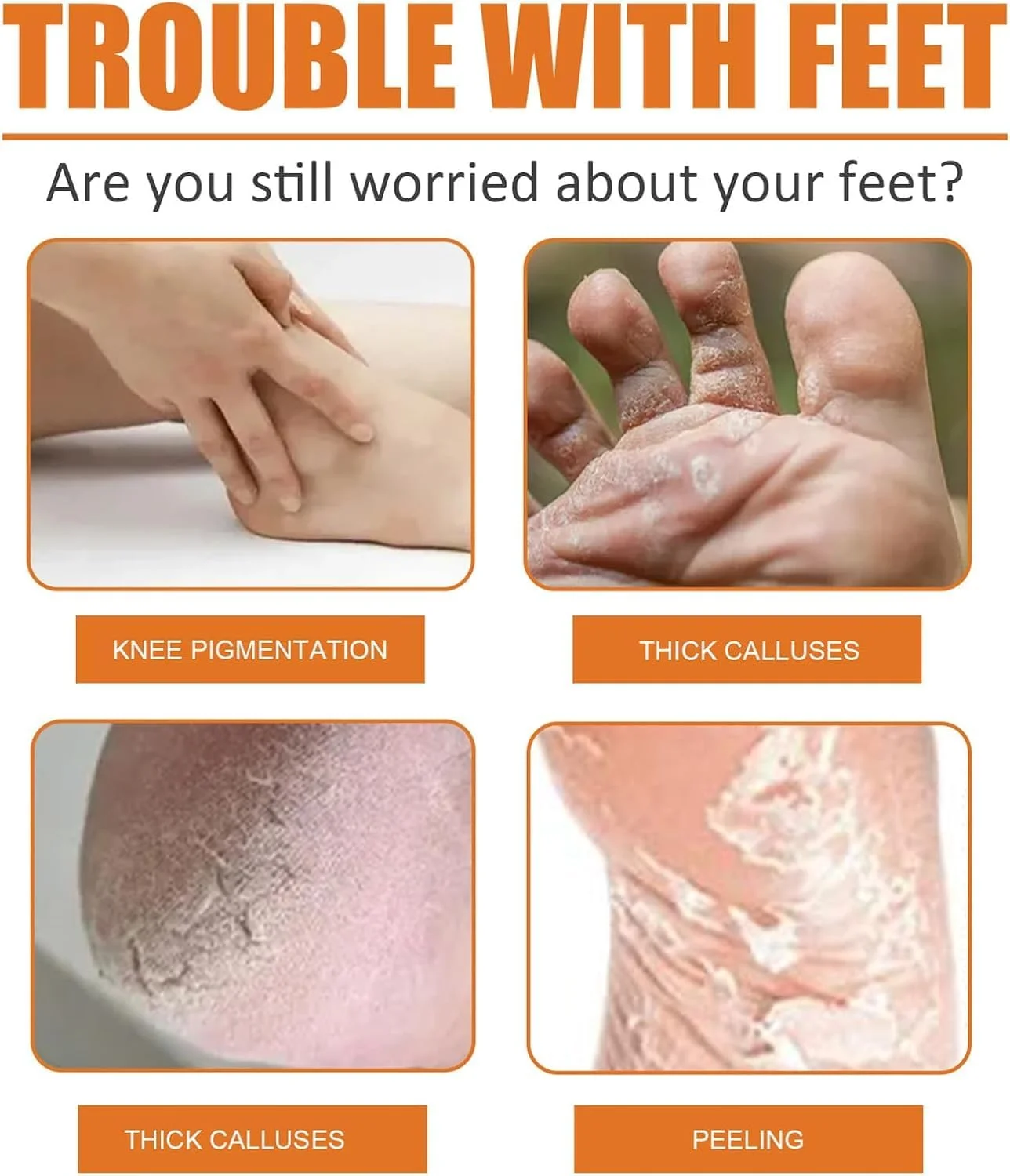 اسپری لایه بردار پا، از بین برنده پوست سخت و ماسک لایه بردار با روغن پرتقال - اسپری لایه بردار آبرسان برای از بین بردن سریع پینه و پوست مرده، ایده آل برای مراقبت از پا (سایز مسافرتی 30 میلی لیتر)