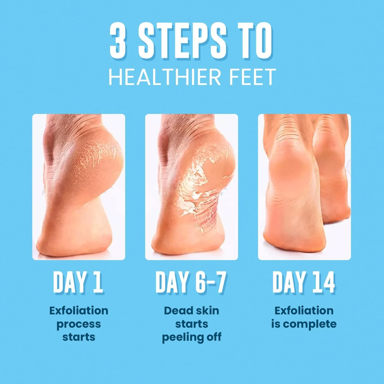 ماسک لایه بردار پا با عصاره شیر بز ABC برای پاهای خشک و ترک خورده، ترمیم کننده پاشنه پا و از بین برنده پوست های مرده و خشک، دستکش های اسپا برای پاهایی نرم و لطیف، مناسب برای آقایان و بانوان