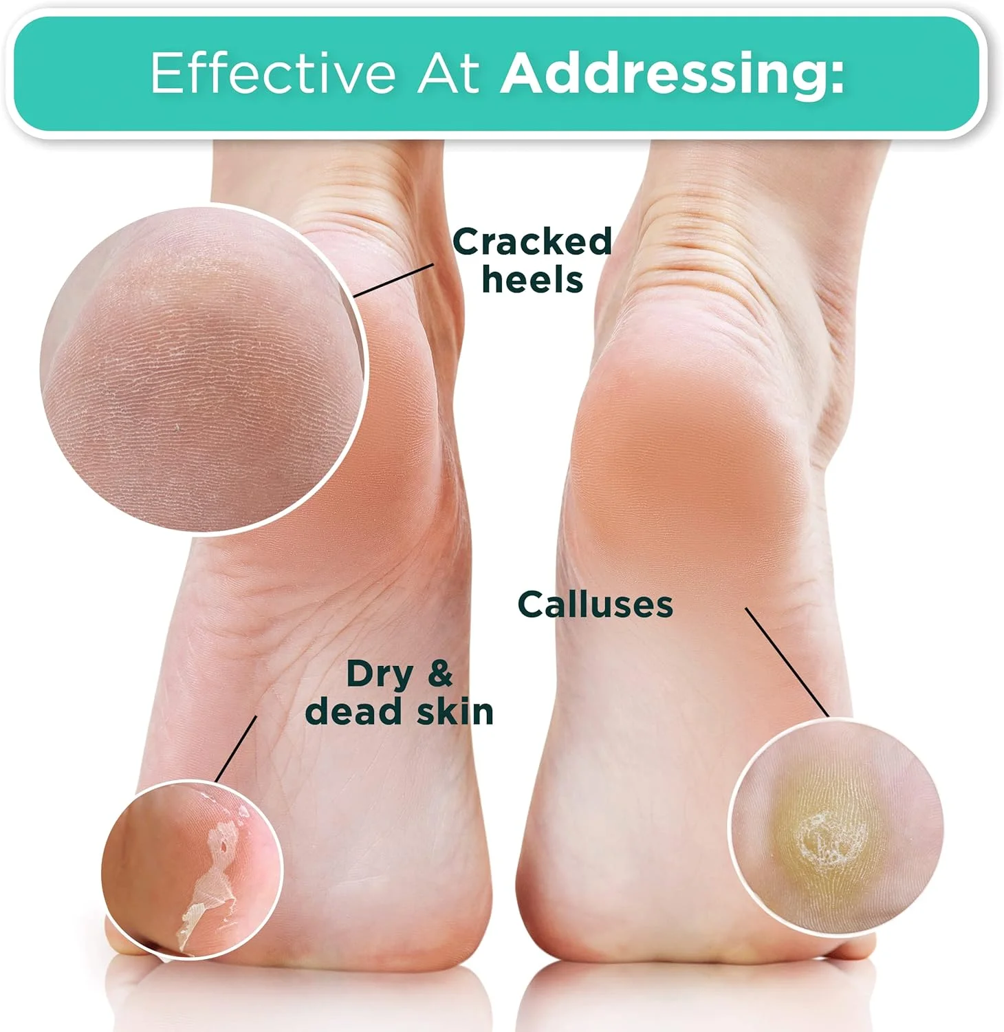 ماسک لایه بردار پا Dermora برای پینه و پوست مرده (بسته 2 عددی)