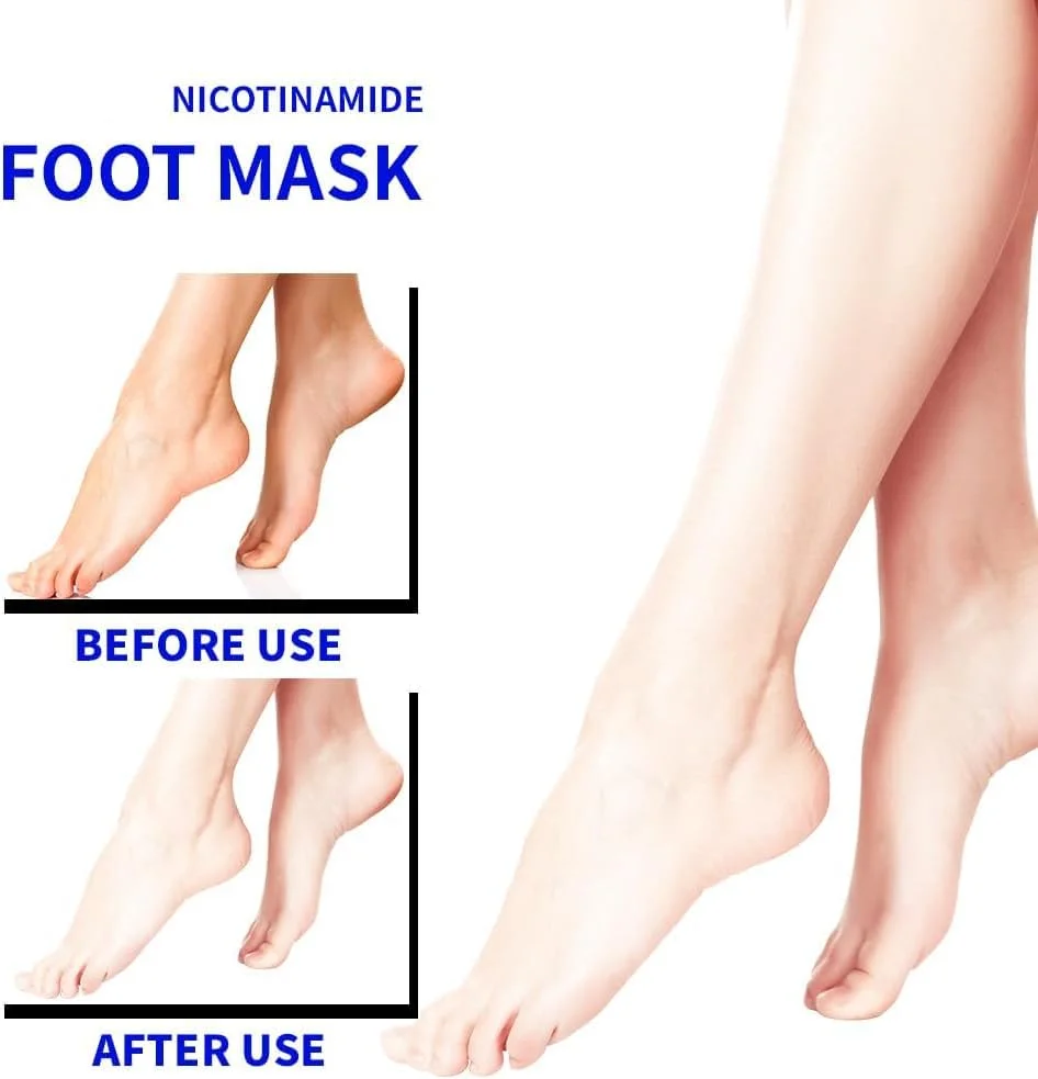 ماسک پا آزونی، بسته 6 عددی، جوراب های مرطوب کننده و آبرسان برای نرم کردن پوست زبر، خشک و ترک خورده پا، حاوی نیاسینامید + شی باتر + شیر بز