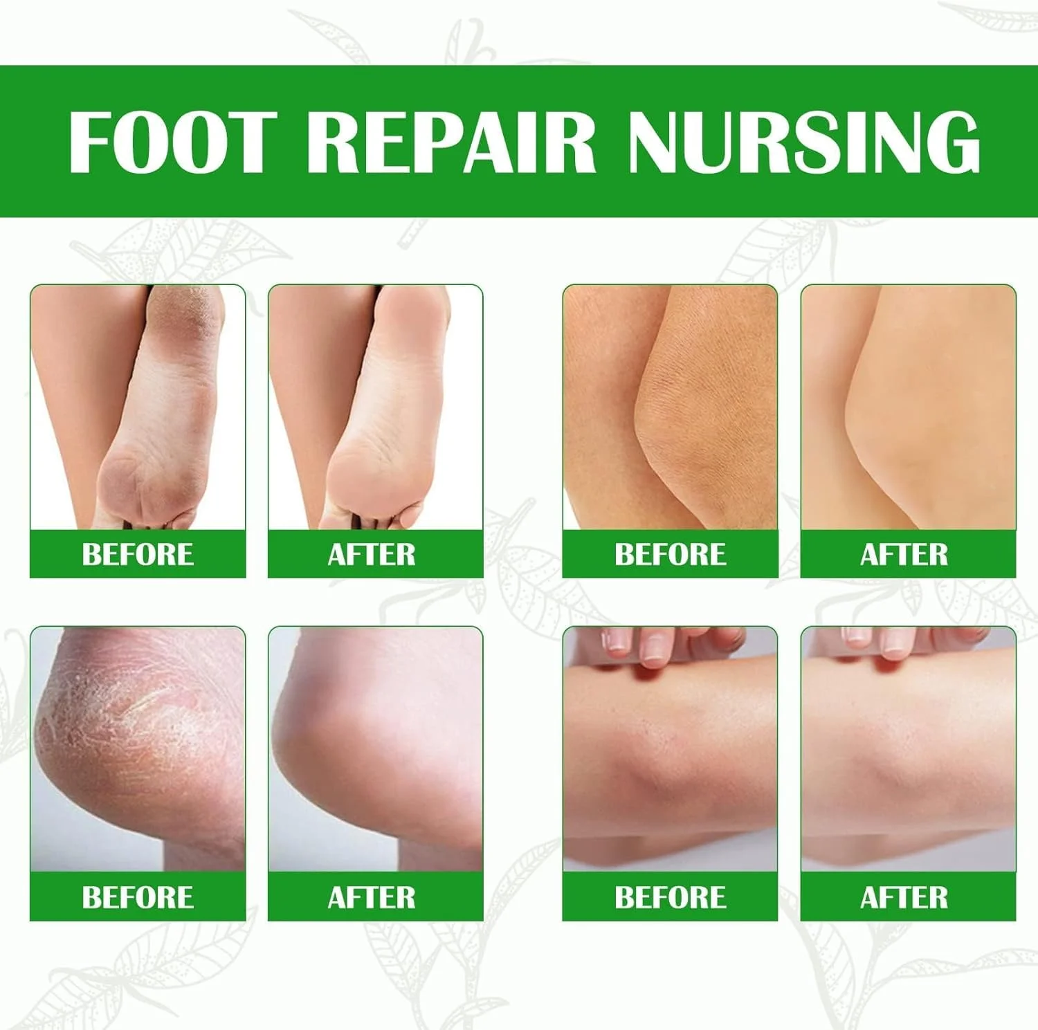 اسپری لایه بردار پا آزونی، از بین برنده فوری پوست مرده پا، اسپری پدیکور لایه بردار برای پینه و پوست خشک انگشتان پا (100 میلی لیتر)