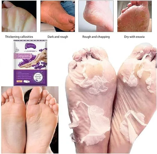 ماسک لایه بردار پا ALIVER، بسته 4 عددی، لایه بردار طبیعی برای پوست های خشک و مرده، پینه، ترمیم پاشنه های زبر برای آقایان و بانوان