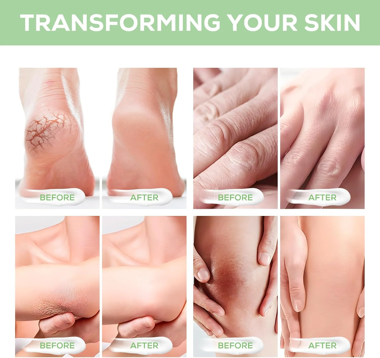 کرم اوره 40% ALIVER با سالیسیلیک اسید 2%، کرم پا برای پوست های خشک، ترک خورده، ضخیم و زبر، مرطوب کننده عمیق، لایه بردار ملایم پوست های مرده و پوسته پوسته شده 150 گرم کرم اوره 40% ALIVER با سالیسیلیک اسید 2%، کرم پا برای پوست های خشک، ترک خورده، ضخیم و زبر، مرطوب کننده عمیق، لایه بردار ملایم پوست های مرده و پوسته پوسته شده 150 گرم