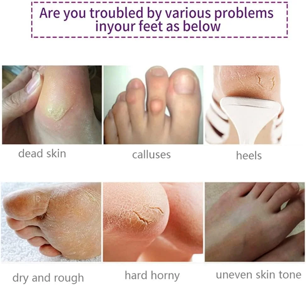 ماسک لایه بردار پا ALIVER، بسته 3 عددی، لایه بردار اسطوخودوس برای پینه، پوست مرده، ترمیم پاشنه های زبر برای زنان و مردان