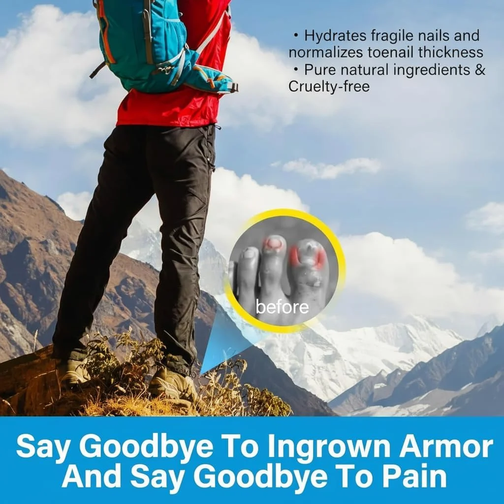 محلول نرم کننده ناخن فرورفته نالاکال، 30 میلی لیتر، قطره های موثر اصلاح کننده ناخن پا برای اصلاح آسان و مراقبت از ناخن، نرم کننده ناخن پا برای برداشتن راحت