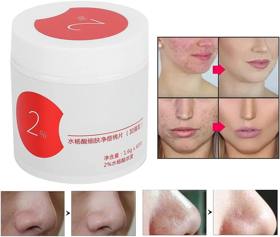 پد پنبه ای رفع آکنه، پد پنبه ای رفع جوش سرسیاه، دستمال مرطوب پاک کننده و ترمیم کننده صورت