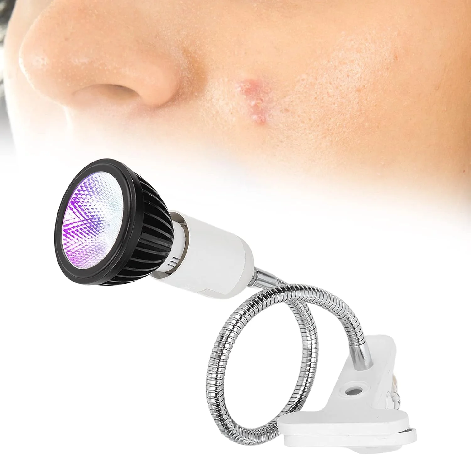 دستگاه لامپ نور آبی، ابزار حذف کننده جای زخم و زردی قابل حمل برای انواع پوست مناسب استفاده حرفه ای و خانگی (آمریکا)