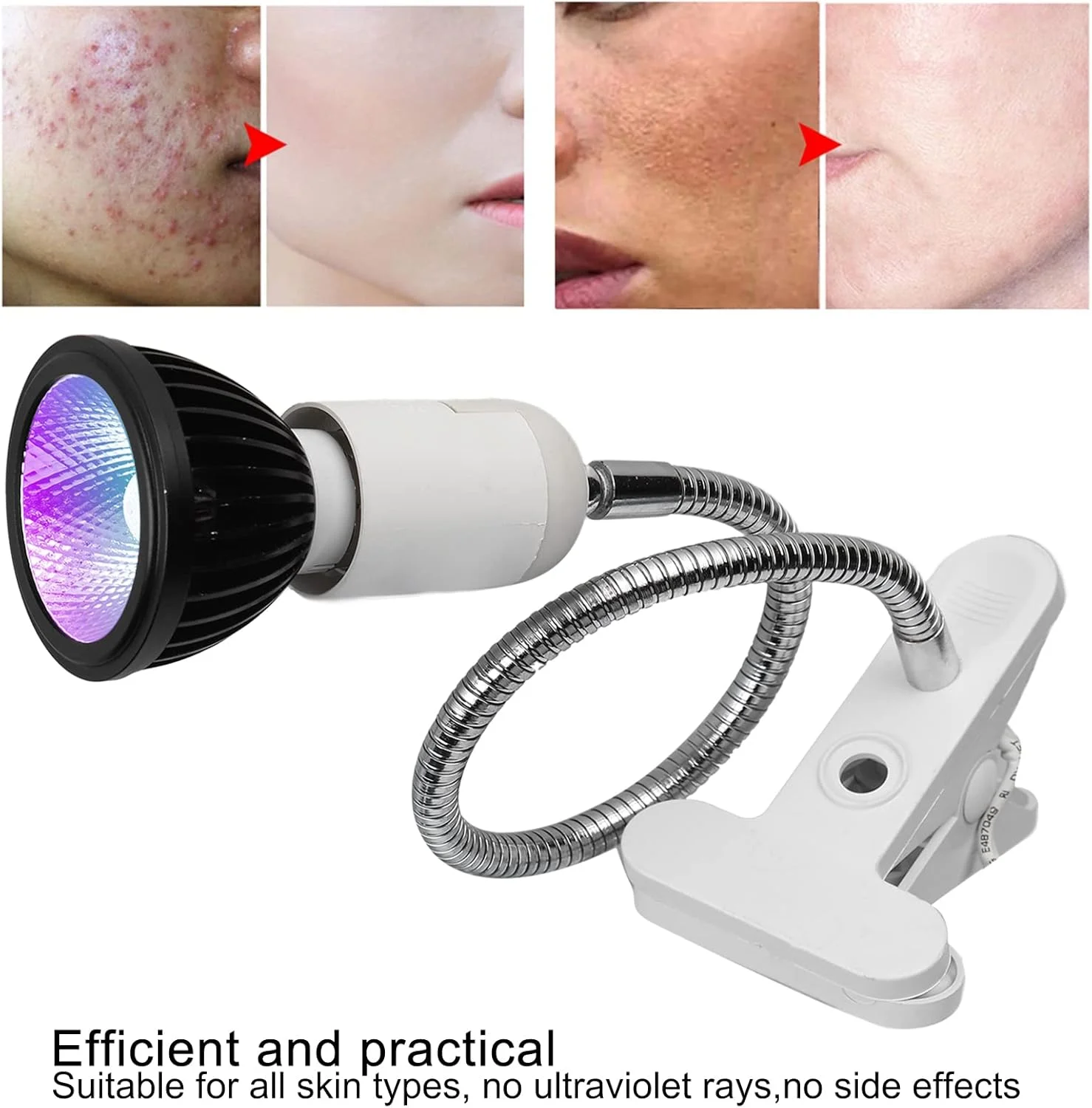 دستگاه لامپ نور آبی، ابزار حذف کننده جای زخم و زردی قابل حمل برای انواع پوست مناسب استفاده حرفه ای و خانگی (آمریکا)