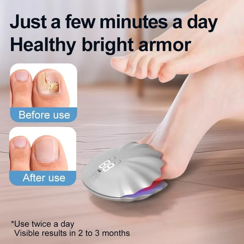 دستگاه لیزر ناخن با تایمر LOMUG، 400 میلی آمپر ساعت، درمان ناخن، سریع و متمرکز، درمان با لیزر سرد قابل شارژ، دستگاه تمیز کننده و مراقبت از ناخن، نور آبی 470 نانومتر و نور مادون قرمز 905 نانومتر دستگاه لیزر ناخن با تایمر LOMUG، 400 میلی آمپر ساعت، درمان ناخن، سریع و متمرکز، درمان با لیزر سرد قابل شارژ، دستگاه تمیز کننده و مراقبت از ناخن، نور آبی 470 نانومتر و نور مادون قرمز 905 نانومتر