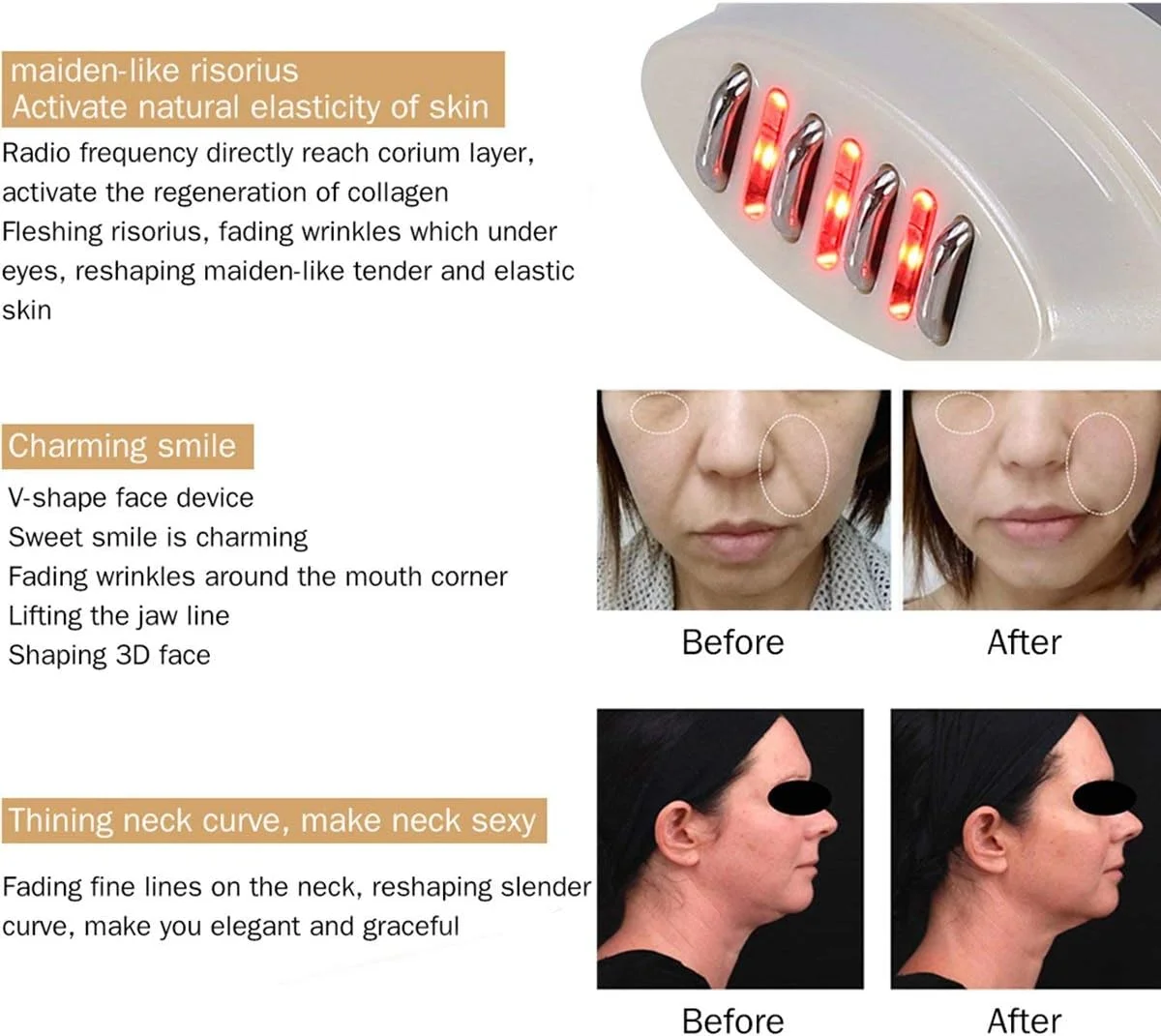 دستگاه مراقبت از پوست با فرکانس رادیویی، دستگاه زیبایی جوانسازی پوست صورت، ماساژور صورت با نور قرمز LED برای پاک کننده صورت، لیفتینگ و ضد چروک، سفت کننده و سفید کننده