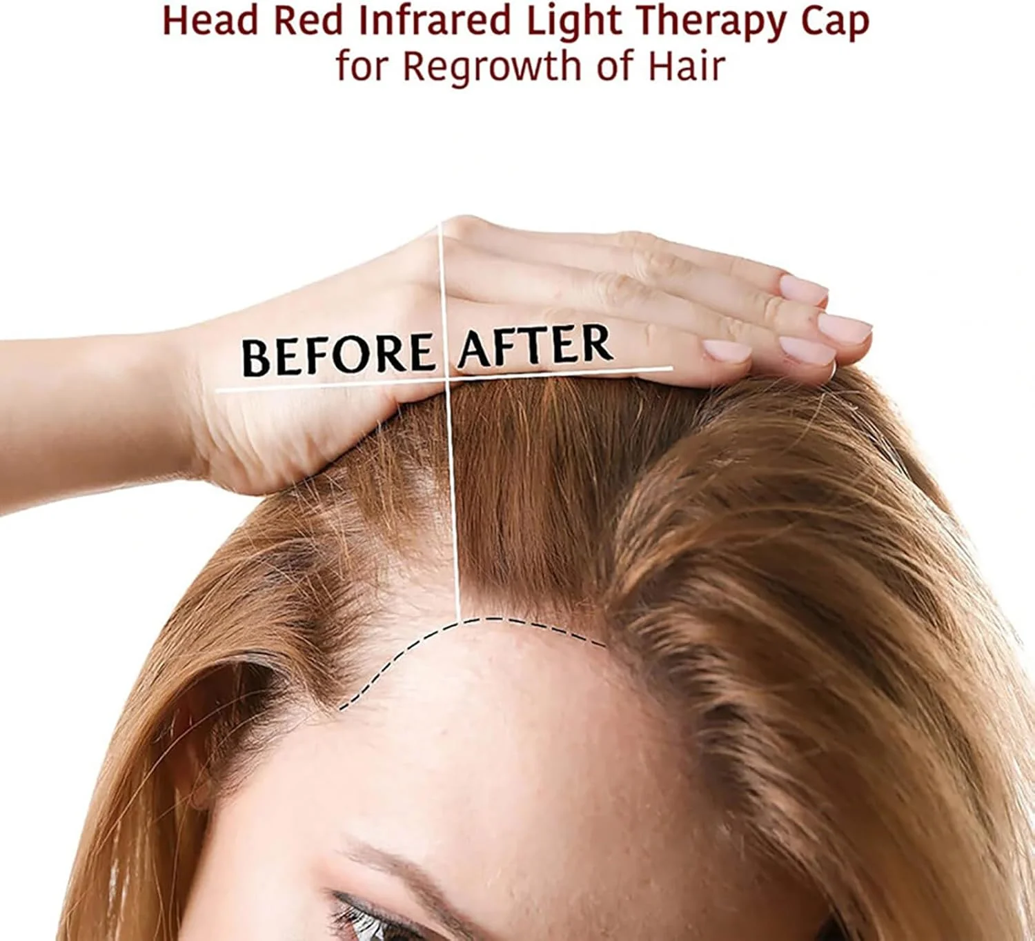 کلاه درمان با نور قرمز ال ای دی، 215 ال ای دی 660 نانومتر 850 نانومتر، کلاه مراقبت از رشد مجدد مو، قابل تنظیم زمان و روشنایی، ترویج مراقبت از رشد مجدد مو و رشد سریع مو برای مردان و زنان